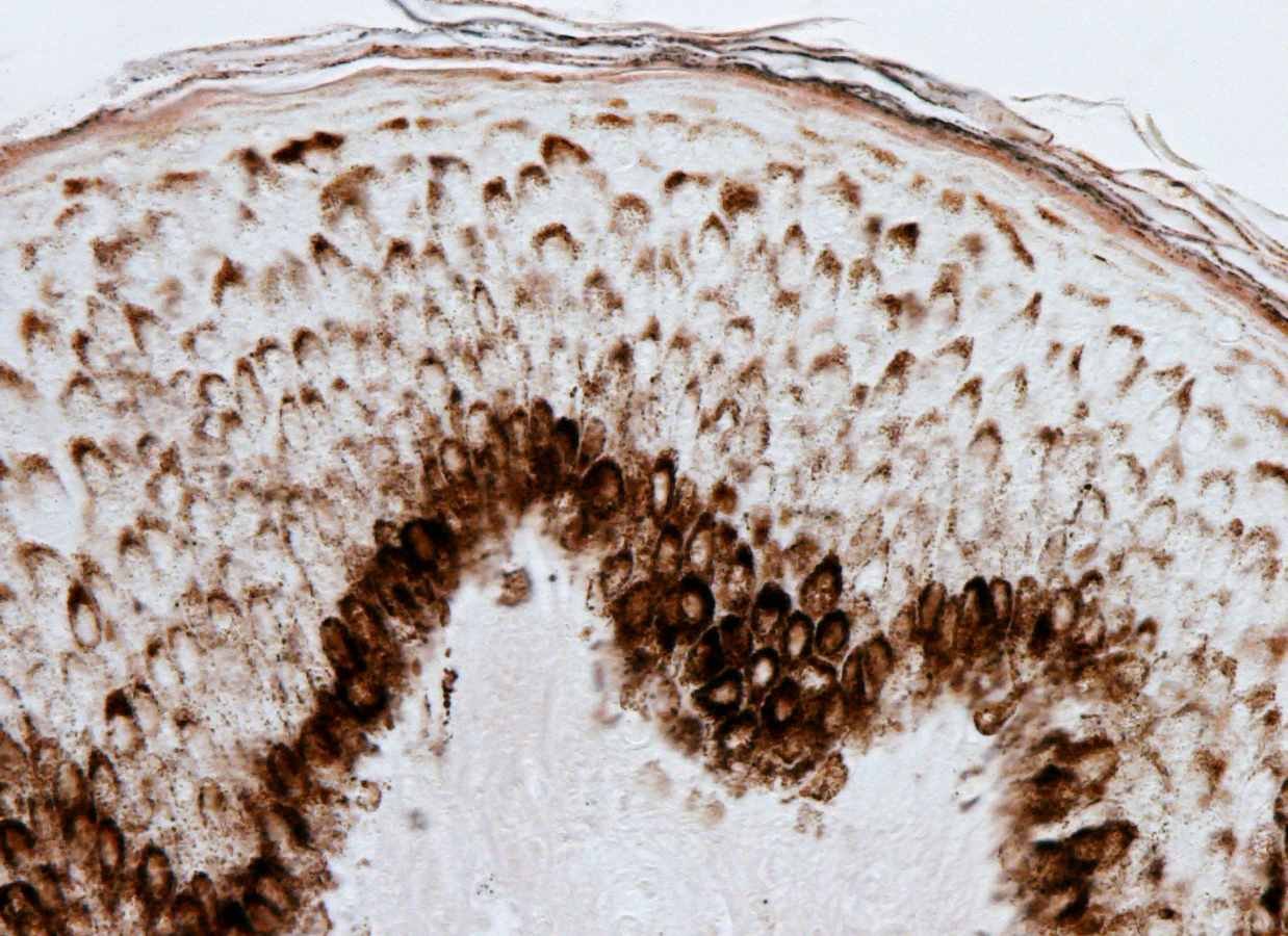 Thin skin epidermis stained with the Fontana silver method showing a large presence of melanin pigment in the basal and spinous layers. The pigmented cells are both melanocytes and keratinocytes. Thin skin epidermis stained with the Fontana silver method showing a large presence of melanin pigment in the basal and spinous layers. The pigmented cells are both melanocytes and keratinocytes.